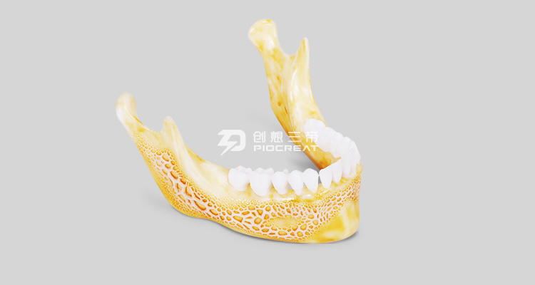 乐鱼-3D打印技术在医疗行业内哪些领域发展比较好